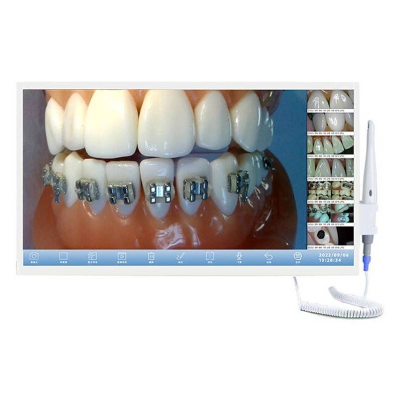 Alta calidad en productos odontológicos personalizados para tratamientos con brackets y ortodoncia.
