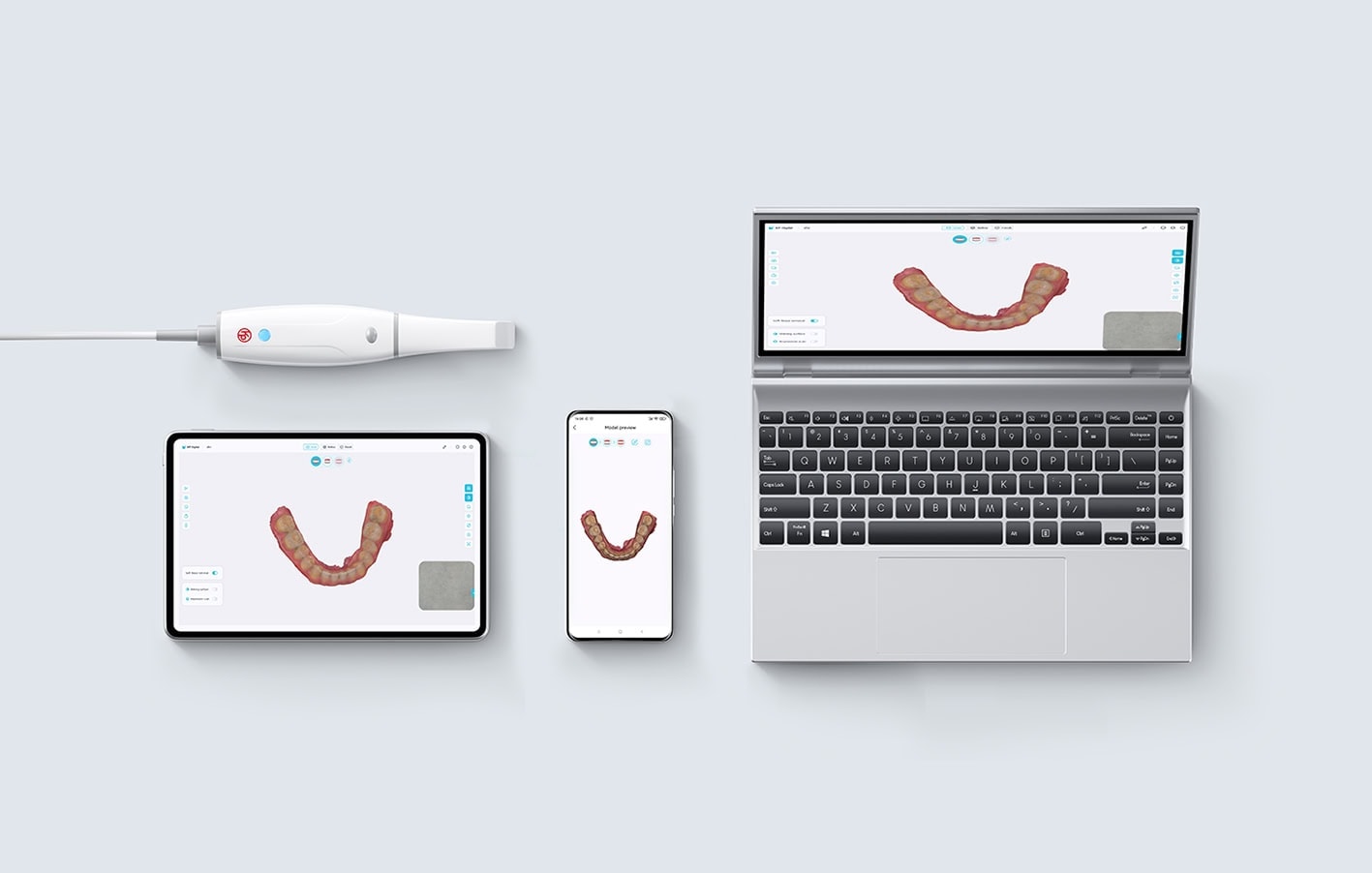 Modelos digitales de prótesis dentales personalizadas en dispositivos electrónicos.