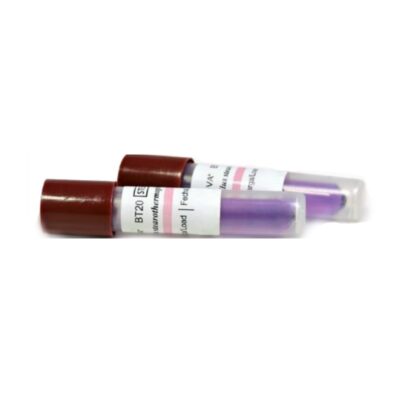 Trompas de extracción de sangre para análisis clínicos, personalizadas, con etiquetas claras y de alta precisión, ideales para laboratorios y clínicas odontológicas, garantizando seguridad y comodidad.