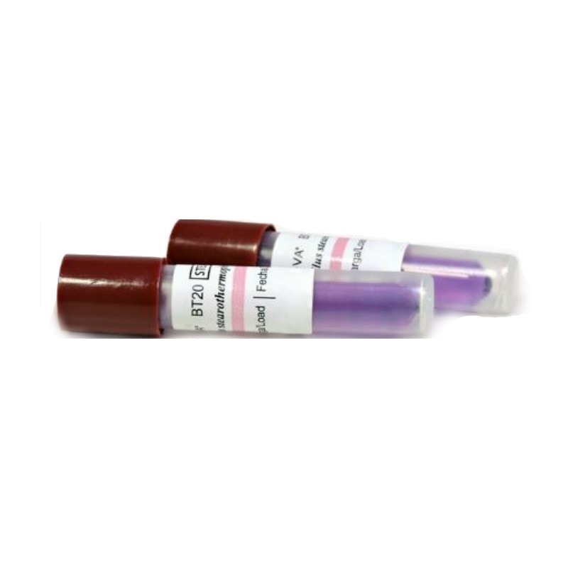 Trompas de extracción de sangre para análisis clínicos, personalizadas, con etiquetas claras y de alta precisión, ideales para laboratorios y clínicas odontológicas, garantizando seguridad y comodidad.