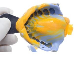 Prótesis e Impresión