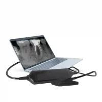 Modelos digitales de radiografías dentales para odontología personalizada en EXAmedic. Equipamiento avanzado para clínicas dentales con alta precisión en diagnóstico y tratamiento.