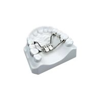 Placa de articulación temporomandibular personalizada para ortodoncia y cirugía dental.