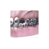 Brackets dentales y aparatología de ortodoncia personalizada para alineación dental y corrección de mordida. Productos odontológicos a medida para tratamientos ortodónticos efectivos y cómodos.